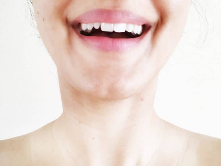 snapseed whiten teeth