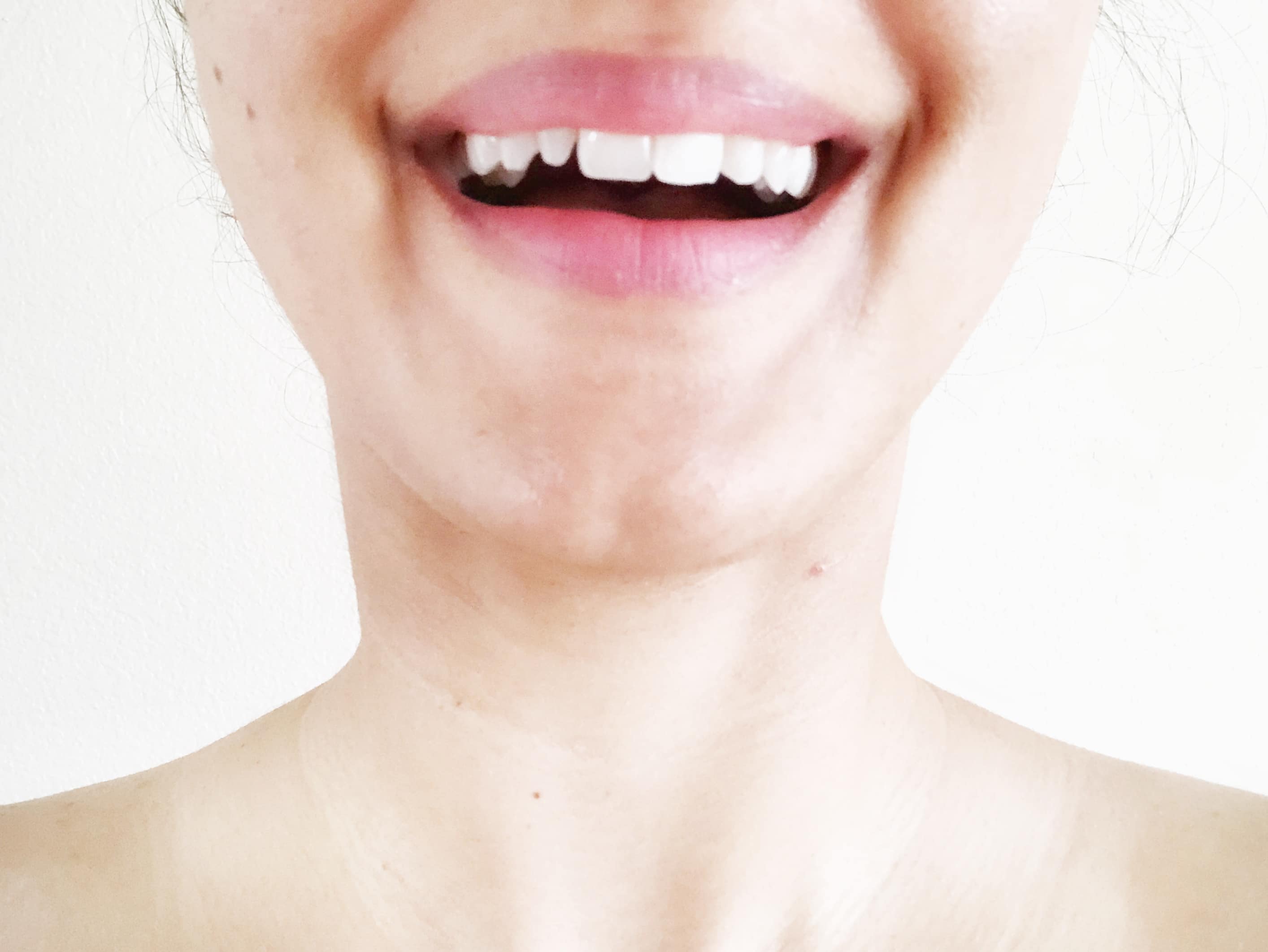 Best At-Home Teeth Whitening Kit - Pros, Cons, & How to Use